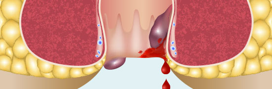 Structures vasculaires